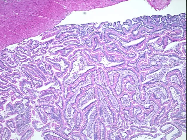 Frozen Tissue Sections, Duodenum - image 1