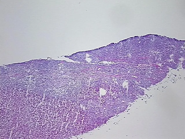 Frozen Tissue Sections, Lymphoid tissue - image 1