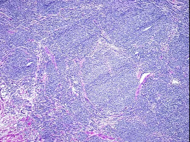 Frozen Tissue Sections, Lymphoid tissue - image 1