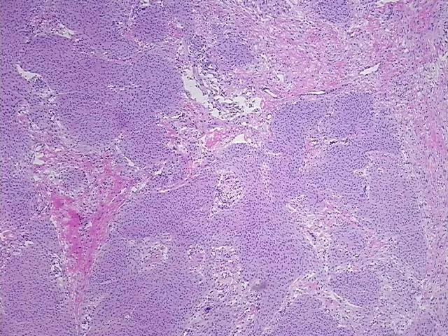 Frozen Tissue Sections, Brain - image 1