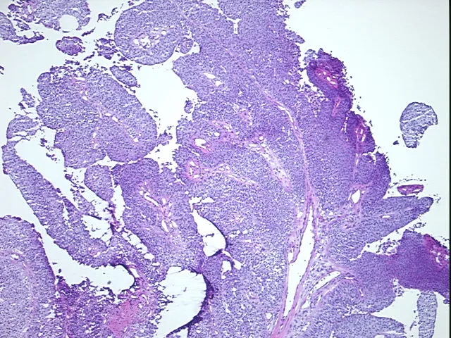 Frozen Tissue Sections, Urinary bladder - image 1