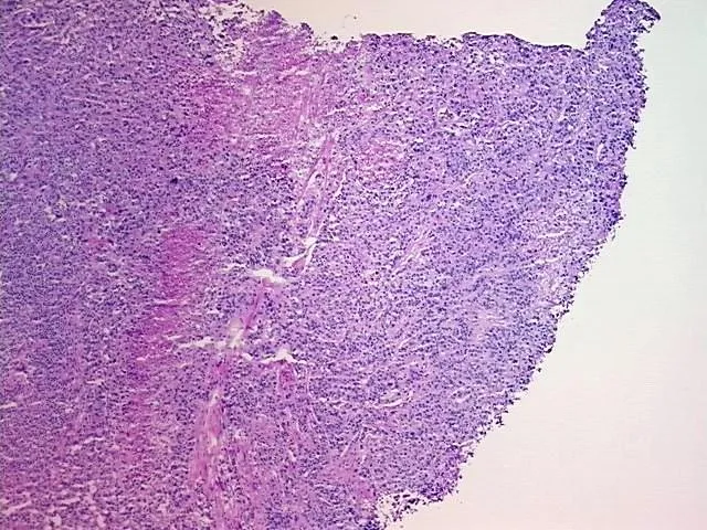 Frozen Tissue Sections, Urinary bladder - image 1