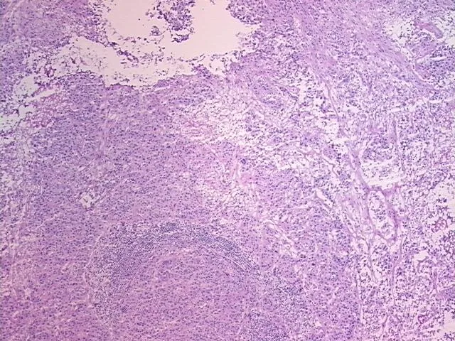Frozen Tissue Sections, Urinary bladder - image 1