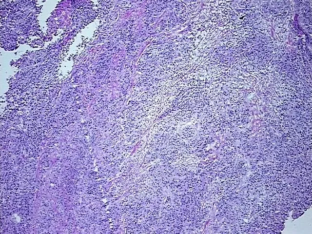 Frozen Tissue Sections, Urinary bladder - image 1