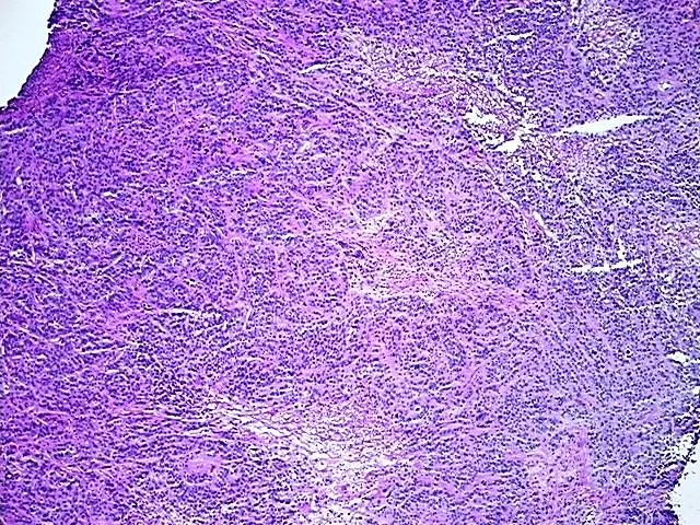 Frozen Tissue Sections, Urinary bladder - image 1