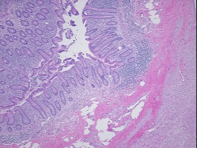 Frozen Tissue Sections, Appendix - image 1