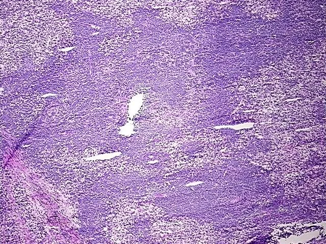 Frozen Tissue Sections, Lymphoid tissue - image 1