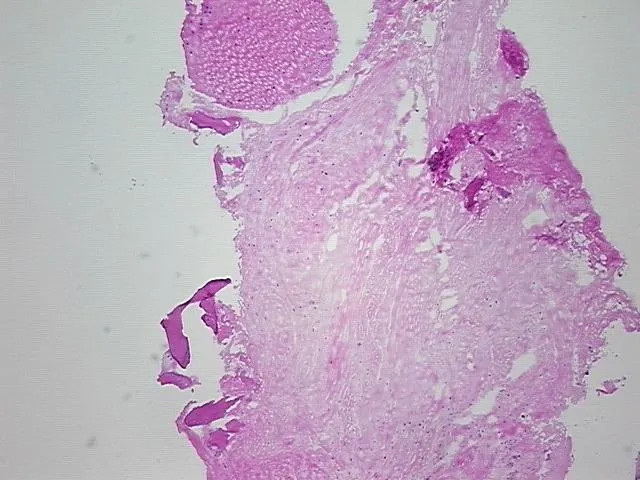 Frozen Tissue Sections, Joint - image 1