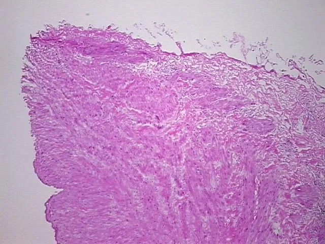 Frozen Tissue Sections, Vein - image 1