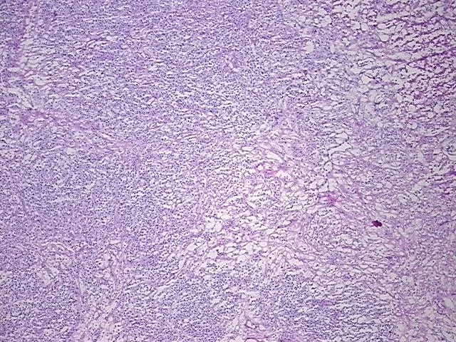 Frozen Tissue Sections, Lymphoid tissue - image 1
