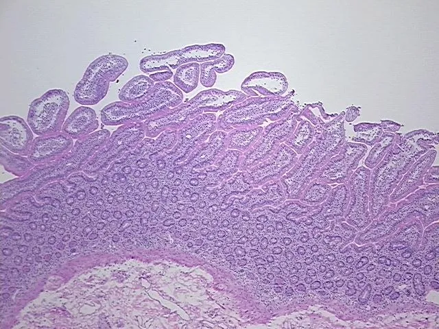 Frozen Tissue Sections, Duodenum - image 1