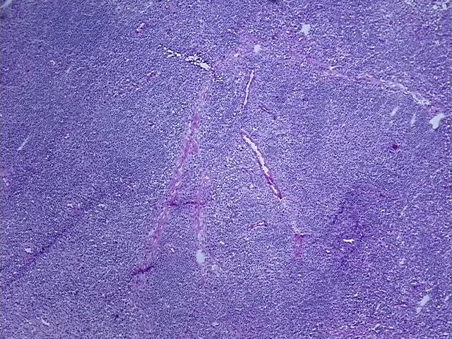 Frozen Tissue Sections, Lymph node - image 1