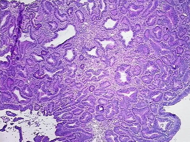 Frozen Tissue Sections, Duodenum - image 1
