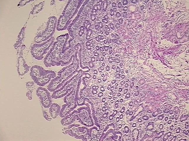 Frozen Tissue Sections, Duodenum - image 1