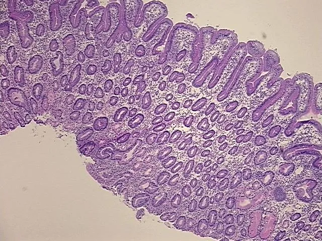 Frozen Tissue Sections, Duodenum - image 1
