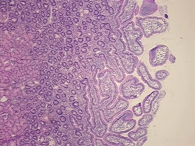 Frozen Tissue Sections, Duodenum - image 1