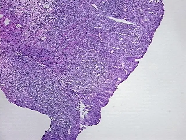 Frozen Tissue Sections, Rectum - image 1