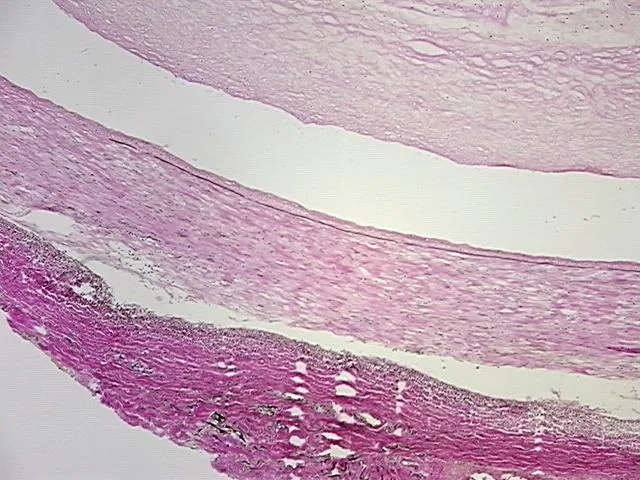 Frozen Tissue Sections, Artery - image 1