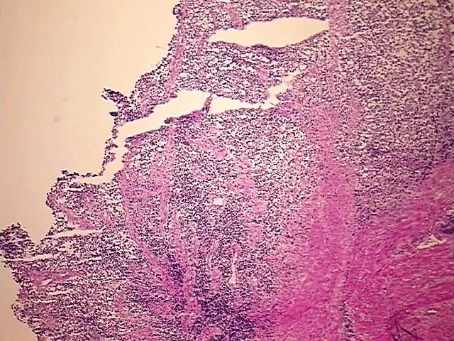 Frozen Tissue Sections, Soft tissue - image 1