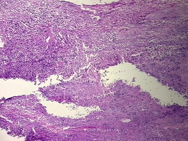 Frozen Tissue Sections, Unknown tissue - image 1