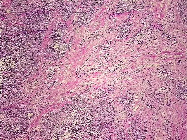 Frozen Tissue Sections, Multiple urinary system sites - image 1