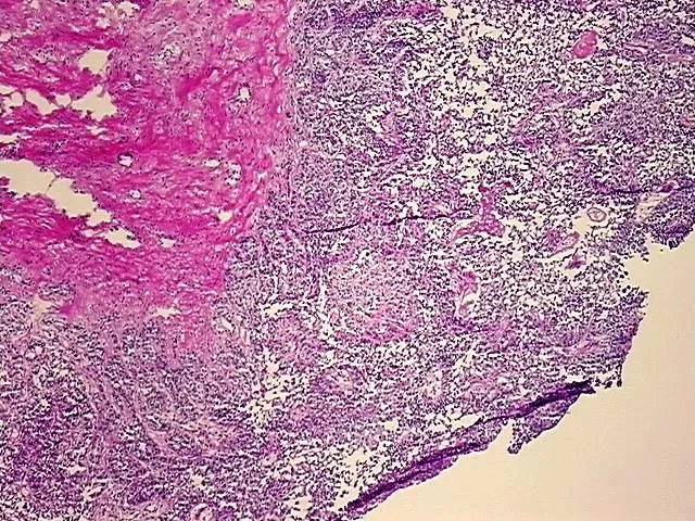 Frozen Tissue Sections, Multiple urinary system sites - image 1