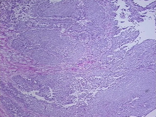 Frozen Tissue Sections, Multiple urinary system sites - image 1