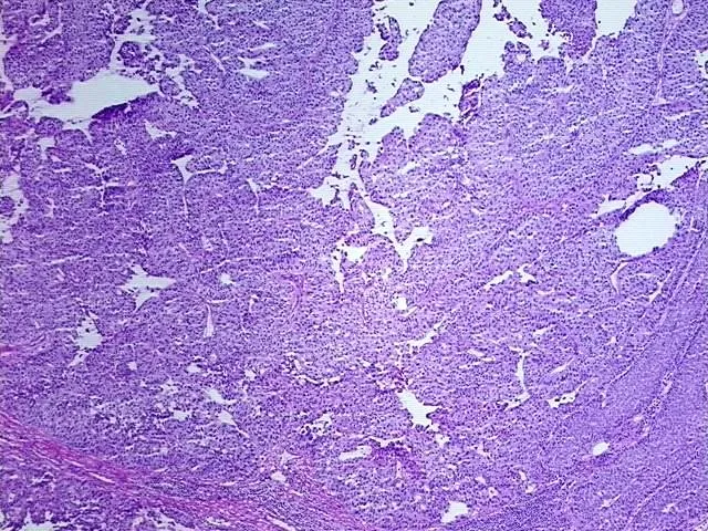 Frozen Tissue Sections, Multiple urinary system sites - image 1