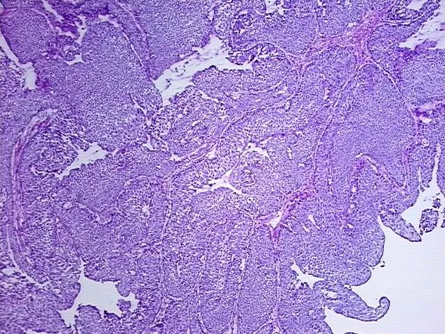 Frozen Tissue Sections, Multiple urinary system sites - image 1