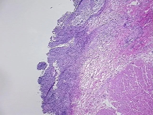 Frozen Tissue Sections, Rectum - image 1