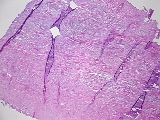 Frozen Tissue Sections, Joint - image 1
