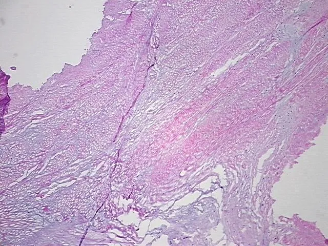 Frozen Tissue Sections, Joint - image 1