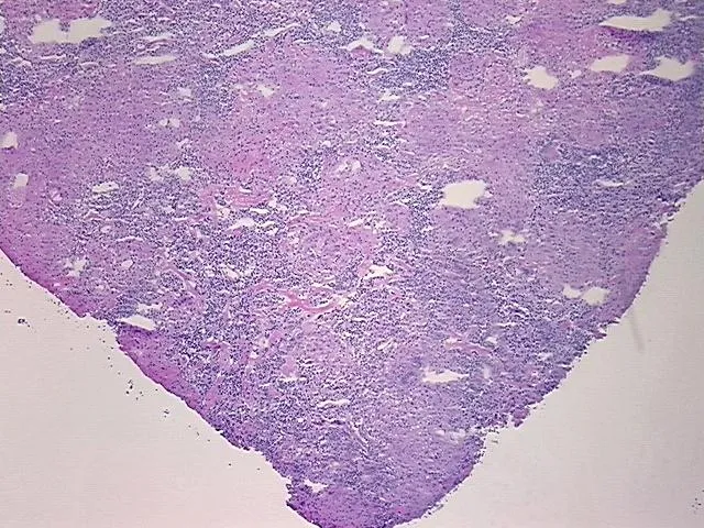 Frozen Tissue Sections, Lymph node - image 1