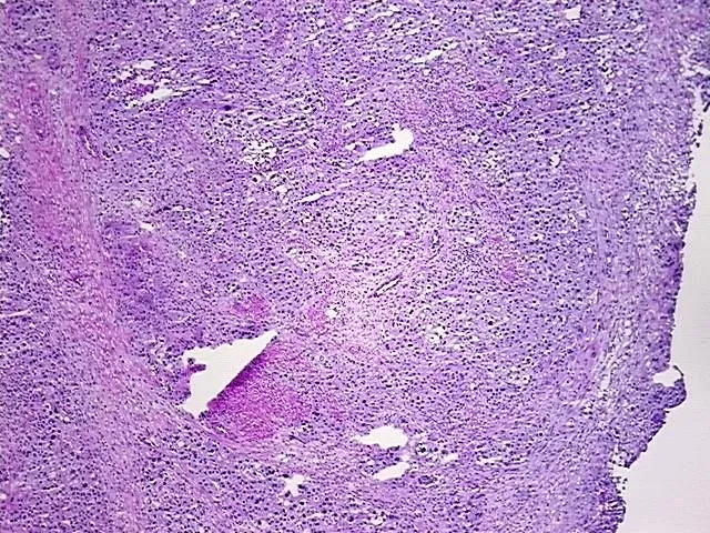 Frozen Tissue Sections, Urinary bladder - image 1