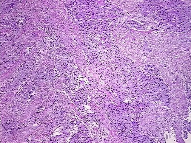 Frozen Tissue Sections, Urinary bladder - image 1
