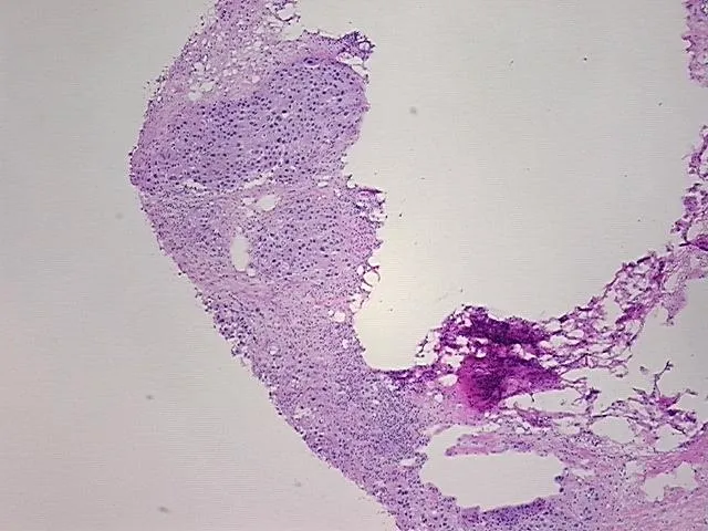 Frozen Tissue Sections, Urinary bladder - image 1