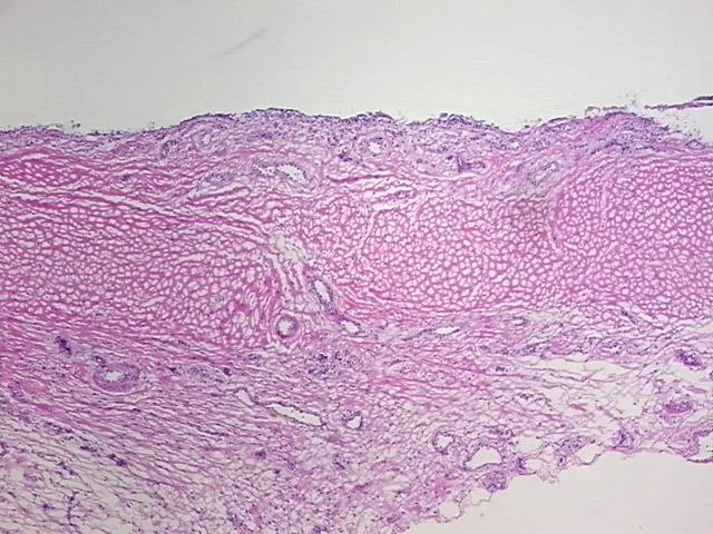 Frozen Tissue Sections, Joint - image 1
