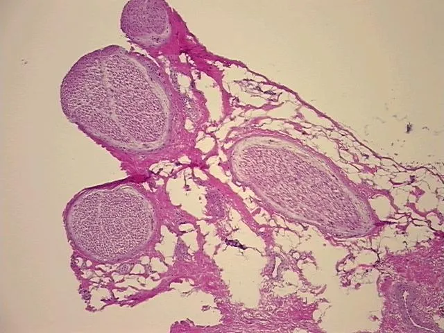 Frozen Tissue Sections, Peripheral nerve - image 1