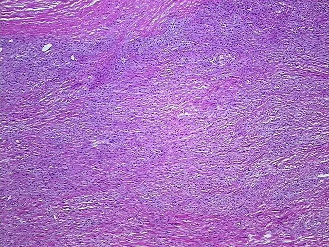 Frozen Tissue Sections, Soft tissue - image 1