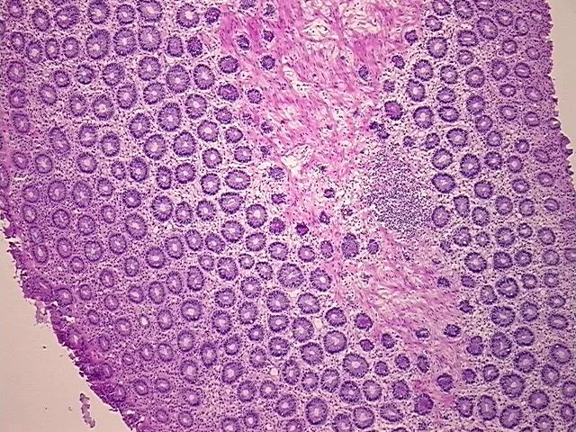 Frozen Tissue Sections, Rectum - image 1