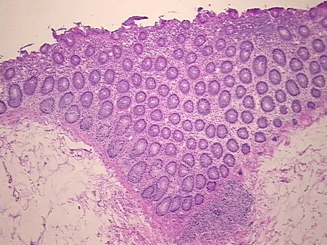 Frozen Tissue Sections, Rectum - image 1