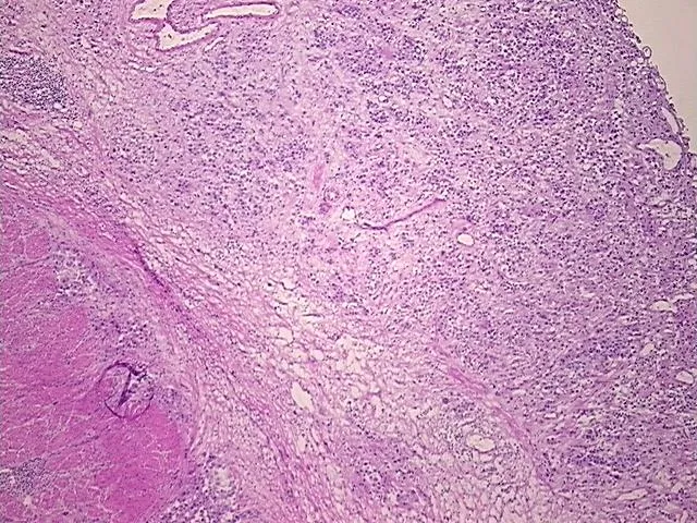 Frozen Tissue Sections, Urinary bladder - image 1