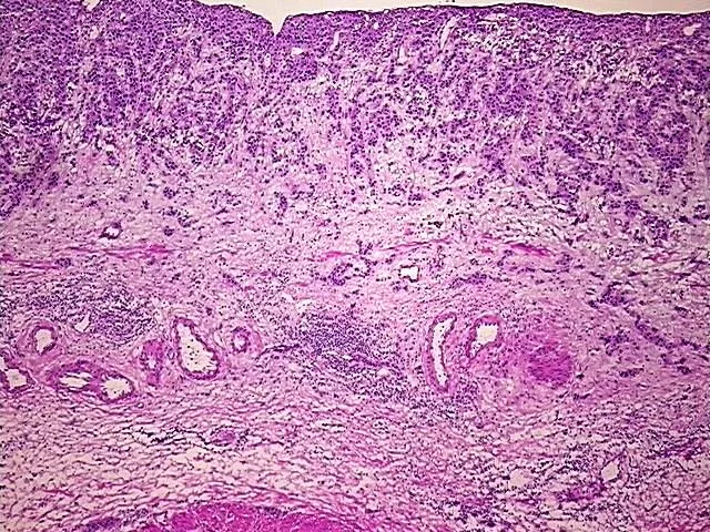 Frozen Tissue Sections, Urinary bladder - image 1