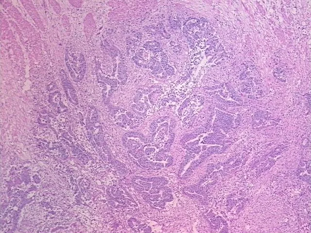 Frozen Tissue Sections, Rectum - image 1