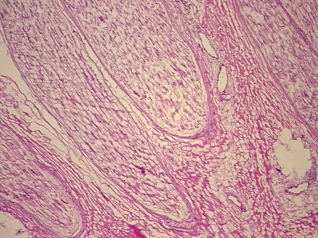 Frozen Tissue Sections, Peripheral nerve - image 1