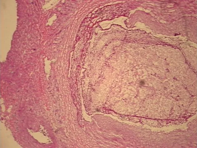 Frozen Tissue Sections, Artery - image 1