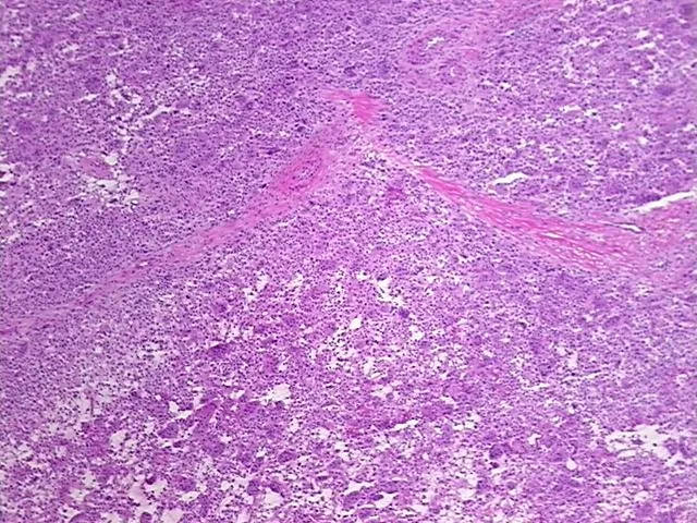 Frozen Tissue Sections, Bone - image 1