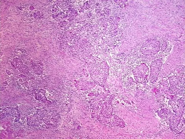 Frozen Tissue Sections, Urinary bladder - image 1