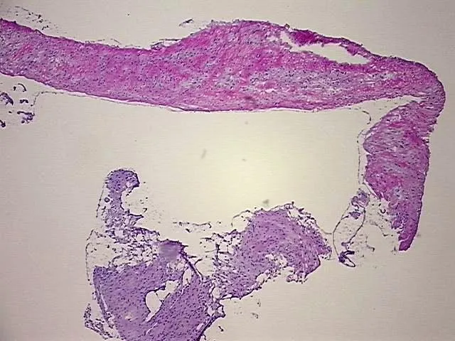 Frozen Tissue Sections, Brain - image 1