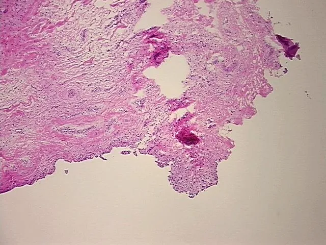 Frozen Tissue Sections, Joint capsule - image 1